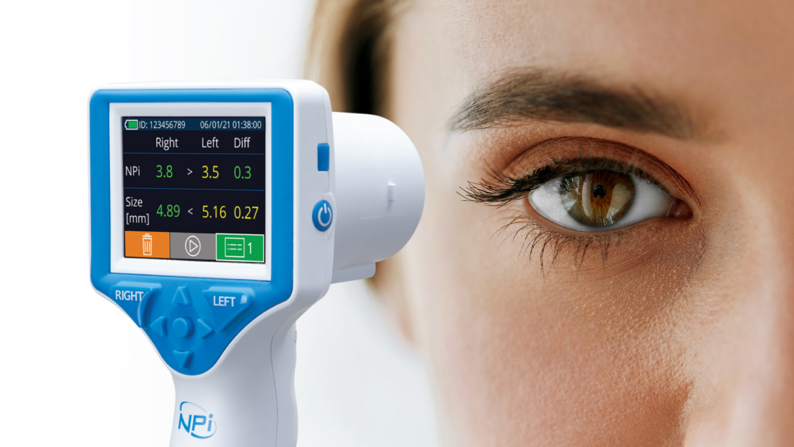Pupillometrie mit NPi