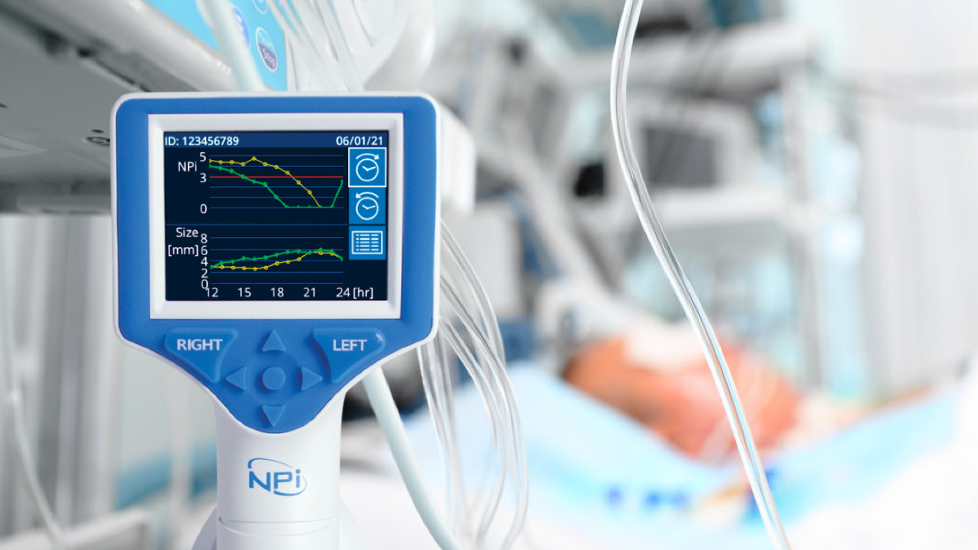 NPi bei Venoarterialer Extra Corporeal Membrane Oxygenation